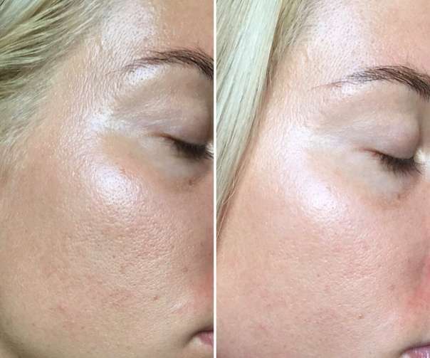 Aizvērtas acs un vaiga divu tuvplānu salīdzinājums